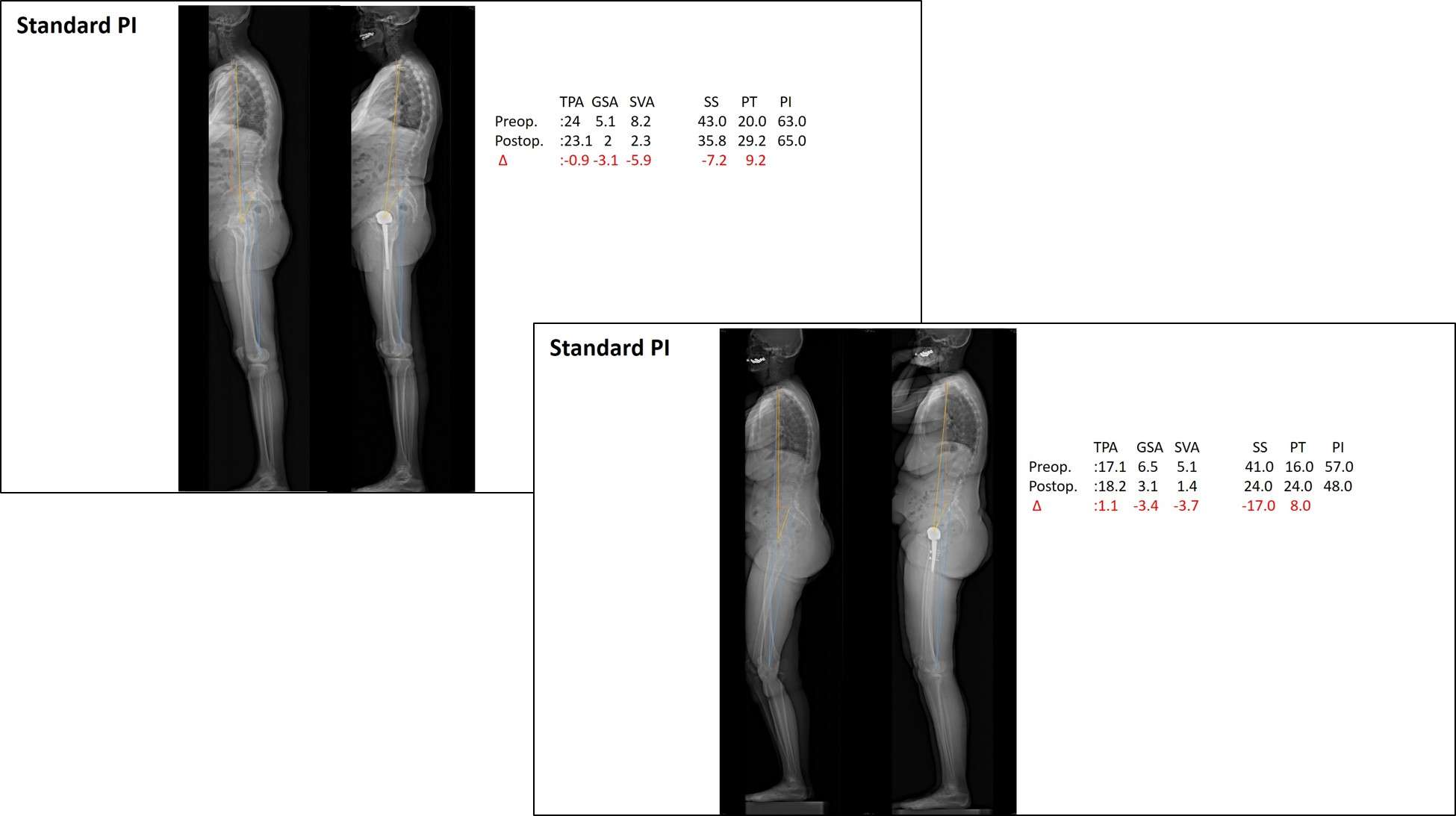 Frontiers | Signatures of disease outcome severity in the intestinal fungal  and bacterial microbiome of COVID-19 patients, image size:1950x1093