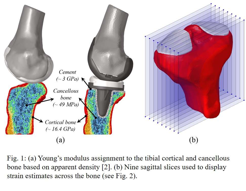 0-120 Degree Adjustable Hinged Knee Leg Brace Protector Bone Orthos