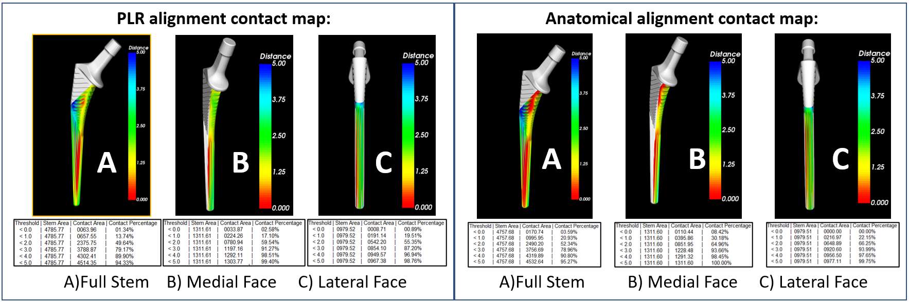 Impact of Joint Laxity Before Total Knee Arthroplasty on