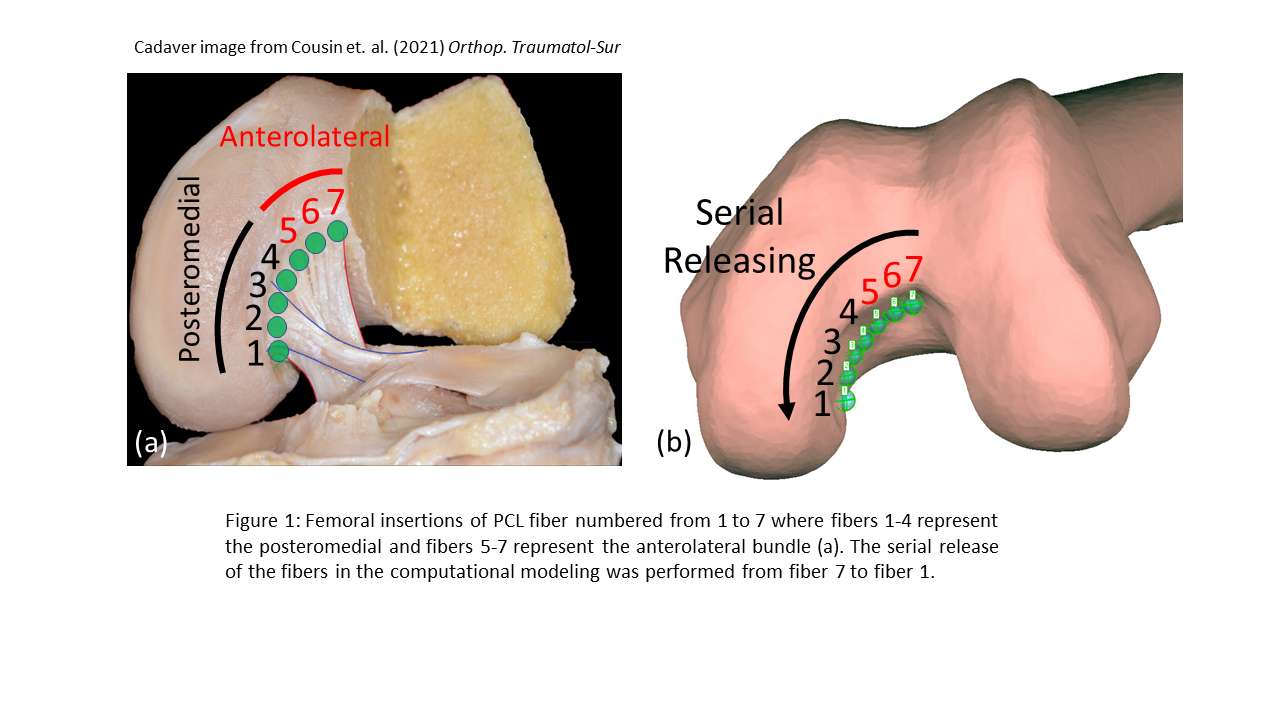 Mini-Posterior Hip Replacement Glendale AZ